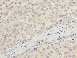 Invitrogen C6orf211 Polyclonal Antibody 100 &mu;g; Unconjugated:Antibodies,