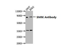 Invitrogen SNRK Polyclonal Antibody 100 &mu;L; Unconjugated:Antibodies,