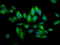 Invitrogen PIGV Polyclonal Antibody 100 &mu;g; Unconjugated:Antibodies,