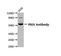 Invitrogen PIGV Polyclonal Antibody 100 &mu;g; Unconjugated:Antibodies,