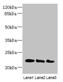 Invitrogen ARL8B Polyclonal Antibody 100 &mu;g; Unconjugated:Antibodies,
