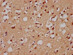 Invitrogen GRHL1 Polyclonal Antibody 100 &mu;L; Unconjugated:Antibodies,