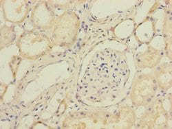 Invitrogen SUCLA2 Polyclonal Antibody 100 &mu;L; Unconjugated:Antibodies,