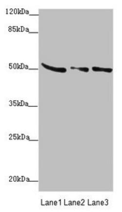Invitrogen SUCLA2 Polyclonal Antibody 100 &mu;L; Unconjugated:Antibodies,