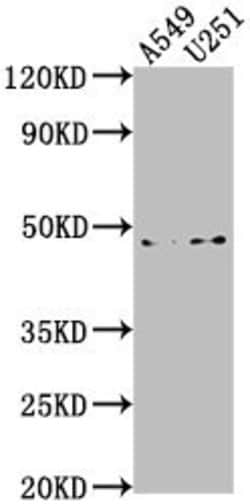 Invitrogen B4GALT6 Polyclonal Antibody 100 &mu;L; Unconjugated:Antibodies,