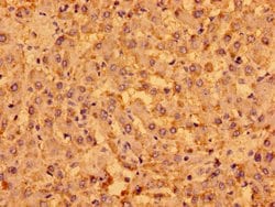 Invitrogen MENT Polyclonal Antibody 100 &mu;g; Unconjugated:Antibodies,