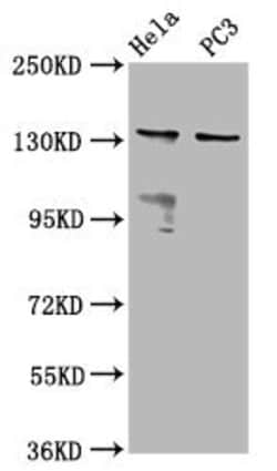 Invitrogen MOV10L1 Polyclonal Antibody 100 &mu;g | Buy Online | Invitrogen&trade; | Fisher Scientific