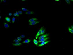 Invitrogen TSCOT Polyclonal Antibody 100 &mu;g; Unconjugated:Antibodies,