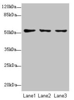 Invitrogen TSCOT Polyclonal Antibody 100 &mu;g; Unconjugated:Antibodies,