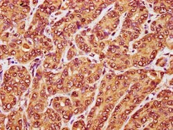 Invitrogen RANBP17 Polyclonal Antibody 100 &mu;g; Unconjugated:Antibodies,