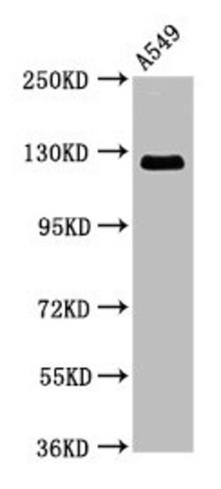 Invitrogen RANBP17 Polyclonal Antibody 100 &mu;g; Unconjugated:Antibodies,