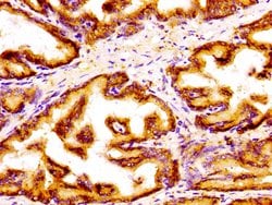 GOLPH3 Polyclonal Antibody:Antibodies, Polyclonal