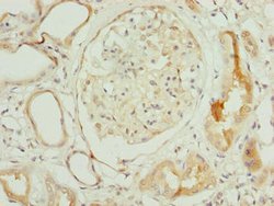 Invitrogen NOLA3 Polyclonal Antibody 100 &mu;g; Unconjugated:Antibodies,