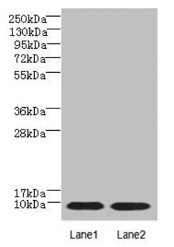 Invitrogen NOLA3 Polyclonal Antibody 100 &mu;g; Unconjugated:Antibodies,
