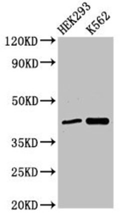 FANCF Polyclonal Antibody:Antibodies, Polyclonal
