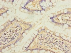 Invitrogen RAB6B Polyclonal Antibody 100 &mu;g | Buy Online | Invitrogen&trade; | Fisher Scientific