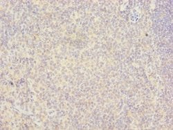 Invitrogen RAB6B Polyclonal Antibody 100 &mu;g | Buy Online | Invitrogen&trade; | Fisher Scientific