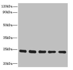 Invitrogen RAB6B Polyclonal Antibody 100 &mu;g | Buy Online | Invitrogen&trade; | Fisher Scientific