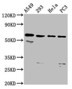 DDX28 Polyclonal Antibody:Antibodies, Polyclonal