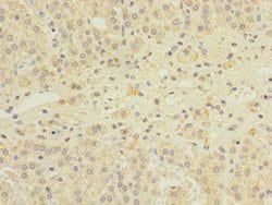 Invitrogen GEMIN8 Polyclonal Antibody 100 &mu;g; Unconjugated:Antibodies,
