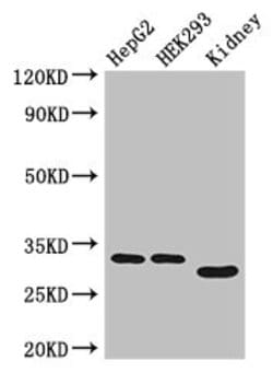 Invitrogen GEMIN8 Polyclonal Antibody 100 &mu;g; Unconjugated:Antibodies,