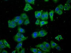 Invitrogen LARS Polyclonal Antibody 100 &mu;L; Unconjugated:Antibodies,
