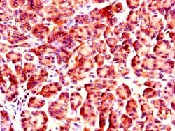 Invitrogen NUP85 Polyclonal Antibody 100 &mu;g; Unconjugated:Antibodies,