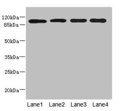 Invitrogen USP26 Polyclonal Antibody 100 &mu;L; Unconjugated:Antibodies,