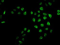 Invitrogen MRO Polyclonal Antibody 100 &mu;g | Buy Online | Invitrogen&trade; | Fisher Scientific