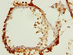 Invitrogen UBXN6 Polyclonal Antibody 100 &mu;g; Unconjugated:Antibodies,