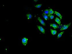Invitrogen SAV1 Polyclonal Antibody 100 &mu;L; Unconjugated:Antibodies,