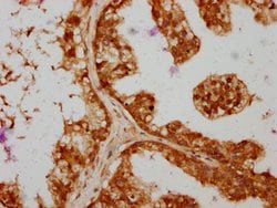 Invitrogen SAV1 Polyclonal Antibody 100 &mu;L; Unconjugated:Antibodies,