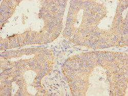 Invitrogen SAV1 Polyclonal Antibody 100 &mu;L; Unconjugated:Antibodies,