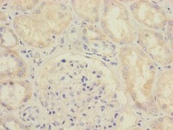 Invitrogen SAV1 Polyclonal Antibody 100 &mu;L; Unconjugated:Antibodies,