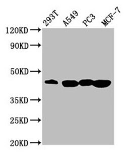 Invitrogen SAV1 Polyclonal Antibody 100 &mu;L; Unconjugated:Antibodies,