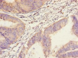 Invitrogen SAV1 Polyclonal Antibody 100 &mu;L; Unconjugated:Antibodies,