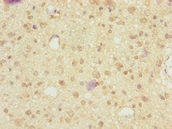 NRXN3 Polyclonal Antibody:Antibodies, Polyclonal