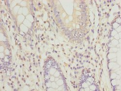 Invitrogen RPRD1B Polyclonal Antibody 100 &mu;g; Unconjugated:Antibodies,