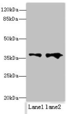 Invitrogen RPRD1B Polyclonal Antibody 100 &mu;g; Unconjugated:Antibodies,