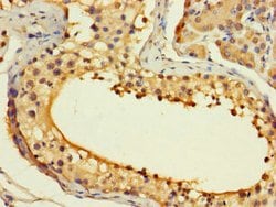 ASF1B Polyclonal Antibody:Antibodies, Polyclonal