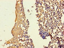 ASF1B Polyclonal Antibody:Antibodies, Polyclonal