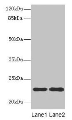 ASF1B Polyclonal Antibody:Antibodies, Polyclonal