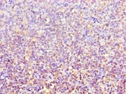 Invitrogen ACTR3B Polyclonal Antibody 100 &mu;L; Unconjugated:Antibodies,