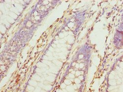 Invitrogen TUBB6 Polyclonal Antibody 100 &mu;g; Unconjugated:Antibodies,