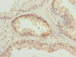 Invitrogen TUBB6 Polyclonal Antibody 100 &mu;g; Unconjugated:Antibodies,