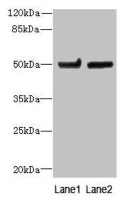 Invitrogen TUBB6 Polyclonal Antibody 100 &mu;g; Unconjugated:Antibodies,