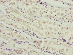 Invitrogen CEP44 Polyclonal Antibody 100 &mu;L | Buy Online | Invitrogen&trade; | Fisher Scientific