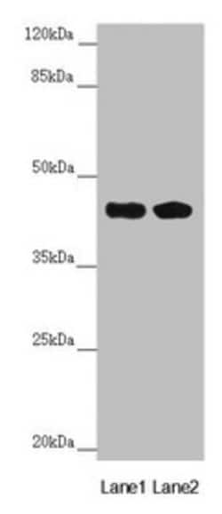 Invitrogen CEP44 Polyclonal Antibody 100 &mu;L | Buy Online | Invitrogen&trade; | Fisher Scientific