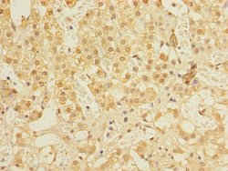 Invitrogen ALS2CR1 Polyclonal Antibody 100 μg; Unconjugated:Antibodies,