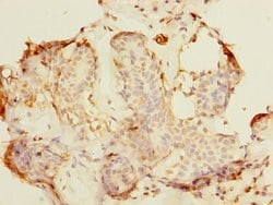 Invitrogen ALS2CR1 Polyclonal Antibody 100 μg; Unconjugated:Antibodies,